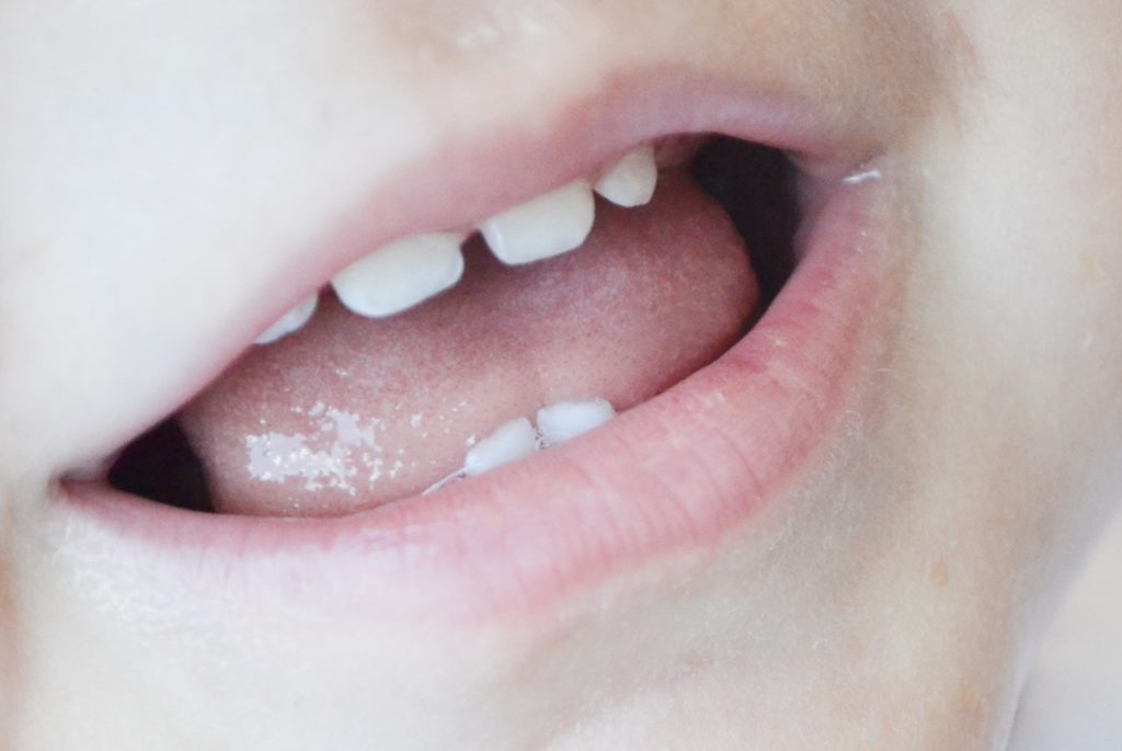 Teething teeth
